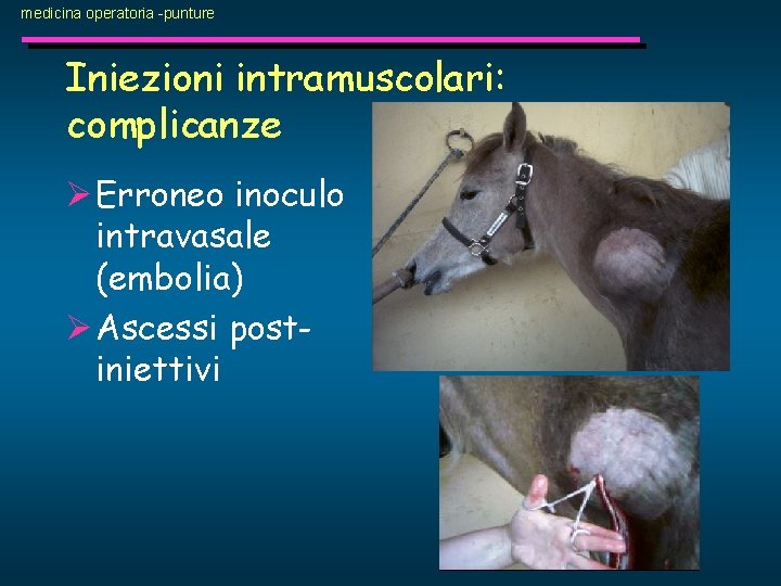 medicina operatoria -punture Iniezioni intramuscolari: complicanze Ø Erroneo inoculo intravasale (embolia) Ø Ascessi postiniettivi