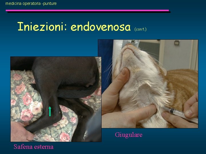 medicina operatoria -punture Iniezioni: endovenosa (cont. ) Giugulare Safena esterna 