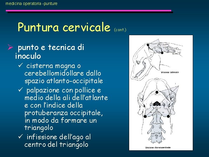 medicina operatoria -punture Puntura cervicale Ø punto e tecnica di inoculo ü cisterna magna