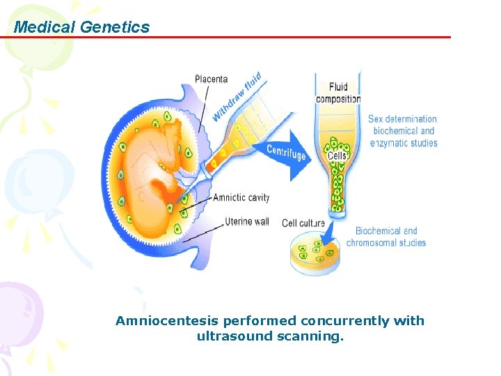 Medical Genetics Amniocentesis performed concurrently with ultrasound scanning. 