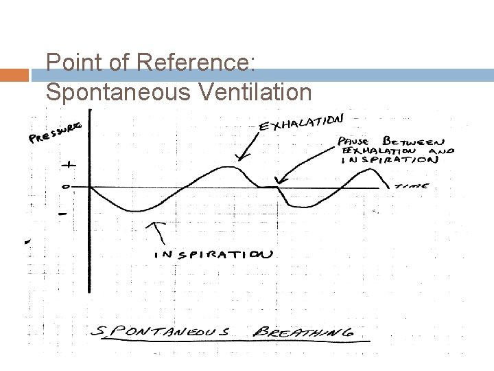 Point of Reference: Spontaneous Ventilation 