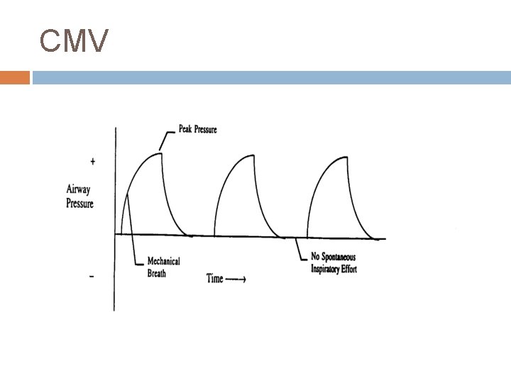 CMV 