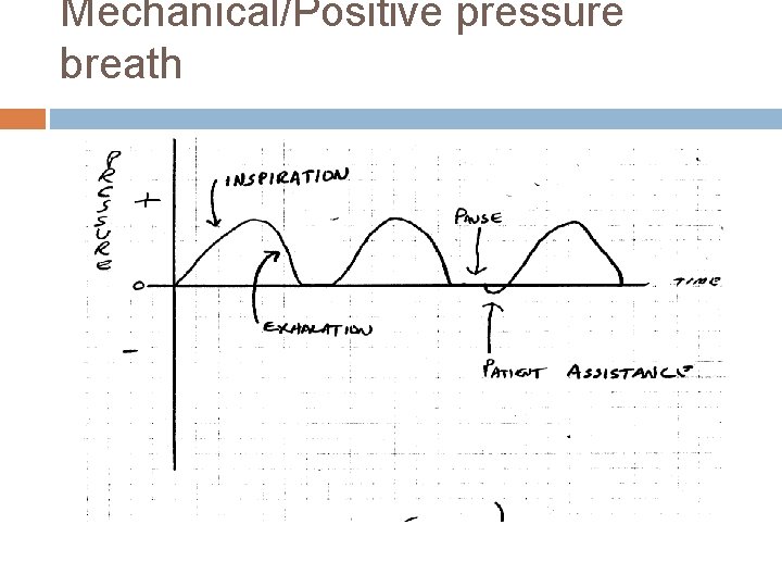 Mechanical/Positive pressure breath 