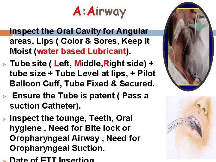 A: Airway Ø Ø Inspect the Oral Cavity for Angular areas, Lips ( Color