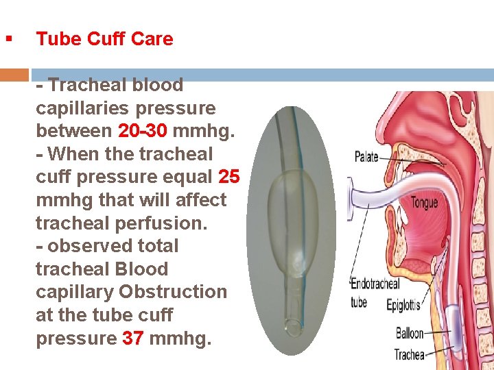 § Tube Cuff Care - Tracheal blood capillaries pressure between 20 -30 mmhg. -