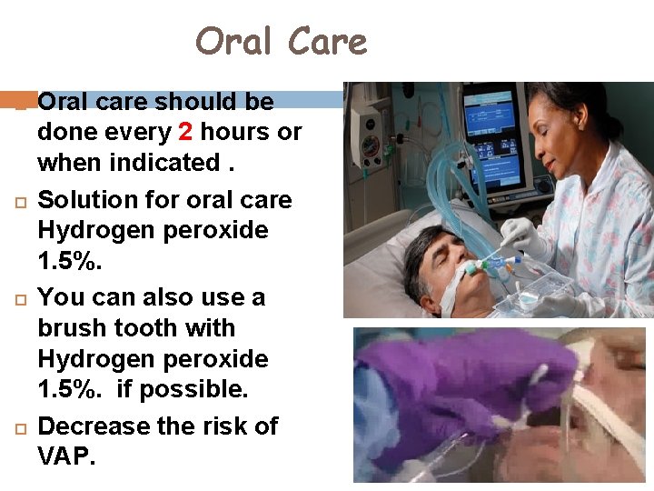 Oral Care Oral care should be done every 2 hours or when indicated. Solution