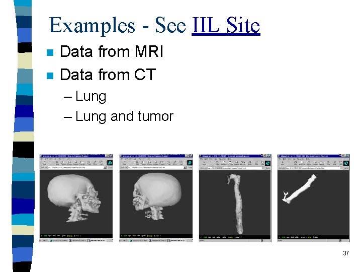 Examples - See IIL Site n n Data from MRI Data from CT –