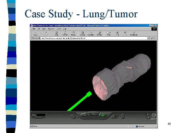 Case Study - Lung/Tumor 45 