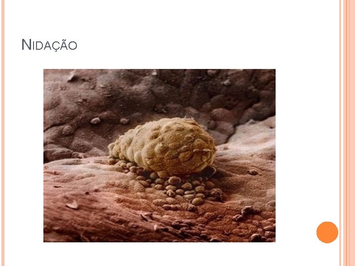 NIDAÇÃO 