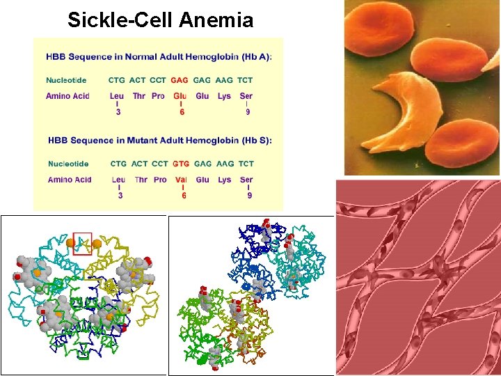 Sickle-Cell Anemia 