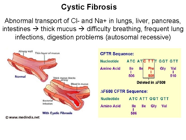 Cystic Fibrosis Abnormal transport of Cl- and Na+ in lungs, liver, pancreas, intestines thick