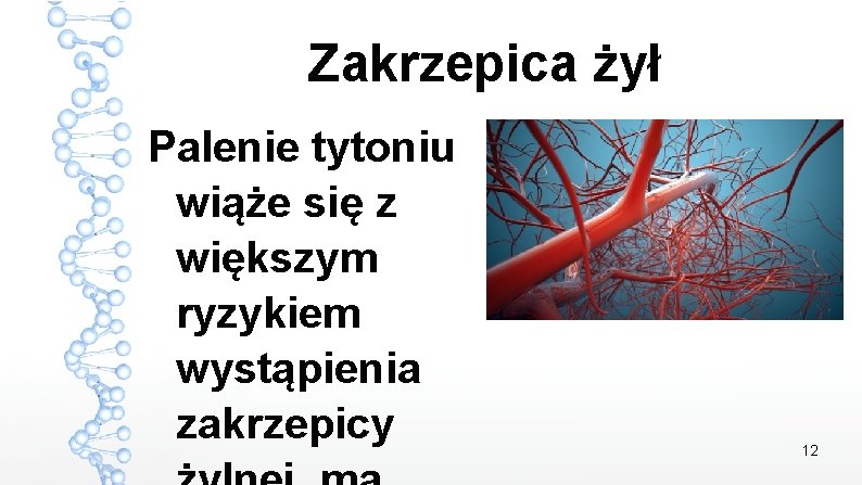 Zakrzepica żył Palenie tytoniu wiąże się z większym ryzykiem wystąpienia zakrzepicy 12 Zakrzepica żył Palenie tytoniu wiąże się z większym ryzykiem wystąpienia zakrzepicy 12