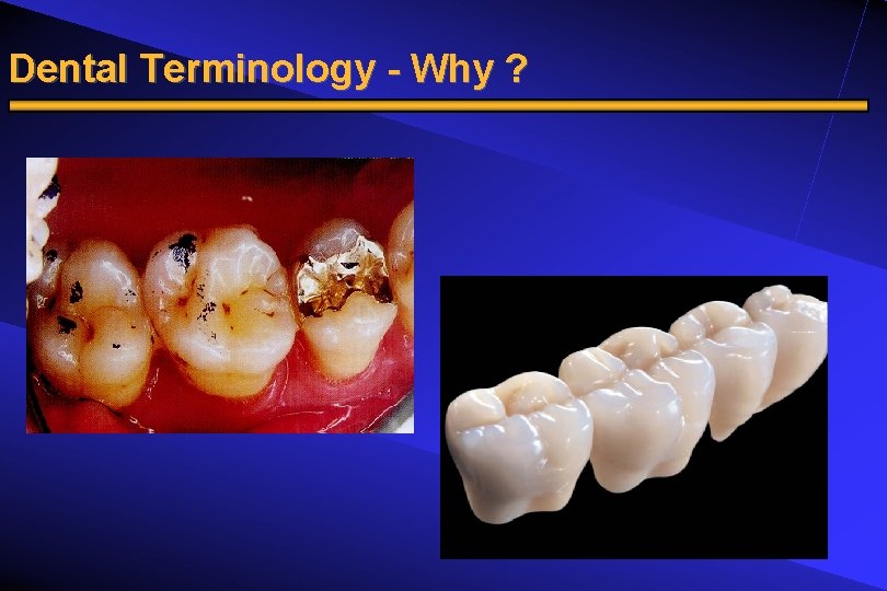 Dental Terminology - Why ? 