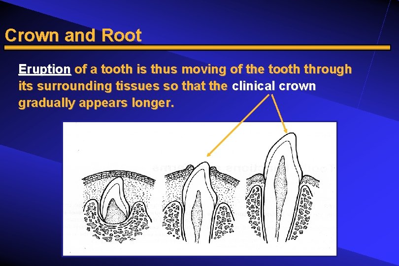 Crown and Root Eruption of a tooth is thus moving of the tooth through