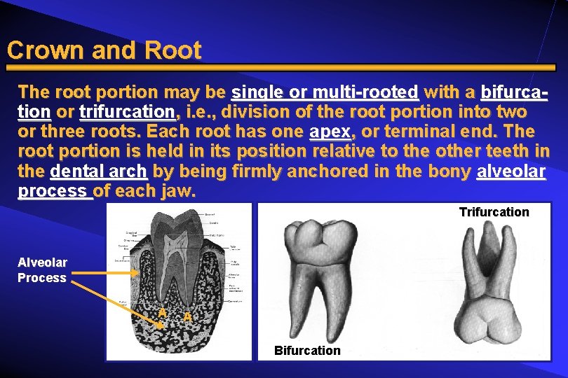 Crown and Root The root portion may be single or multi-rooted with a bifurcation