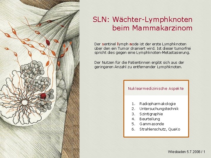 SLN: Wächter-Lymphknoten beim Mammakarzinom Der sentinel lymph node ist der erste Lymphknoten über den