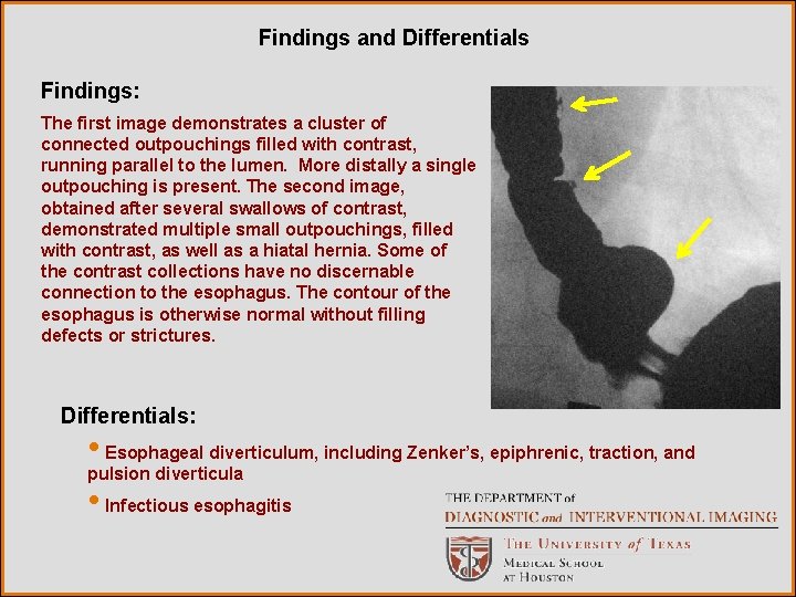 Findings and Differentials Findings: The first image demonstrates a cluster of connected outpouchings filled