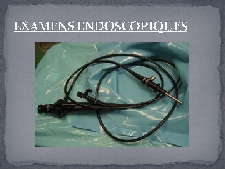 EXAMENS ENDOSCOPIQUES EXAMENS ENDOSCOPIQUES