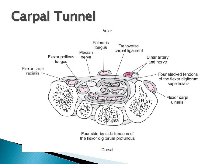 Carpal Tunnel 