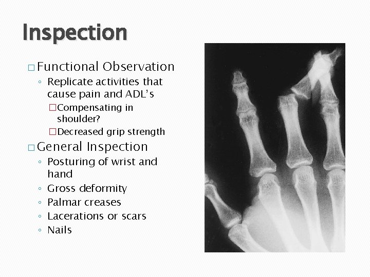 Inspection � Functional Observation ◦ Replicate activities that cause pain and ADL’s �Compensating in