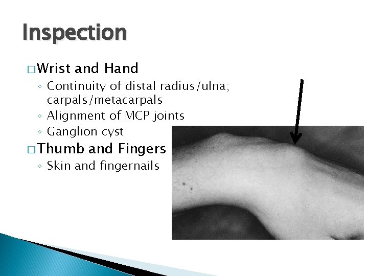 Inspection � Wrist and Hand ◦ Continuity of distal radius/ulna; carpals/metacarpals ◦ Alignment of