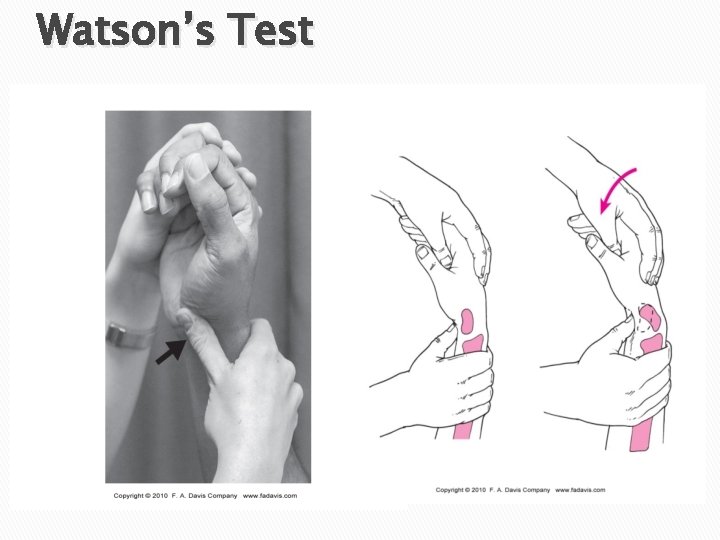 Watson’s Test 