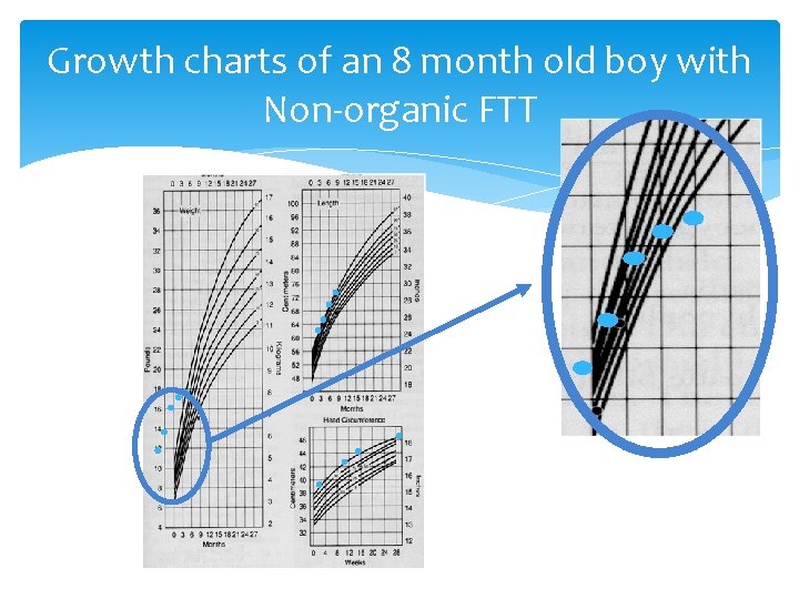 Growth charts of an 8 month old boy with Non-organic FTT 