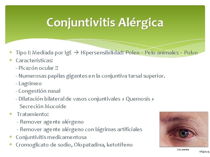 Conjuntivitis Alérgica Tipo I: Mediada por Ig. E Hipersensibilidad: Polen – Pelo animales –