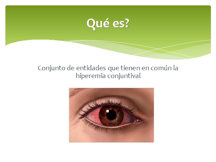Qué es? Conjunto de entidades que tienen en común la hiperemia conjuntival 