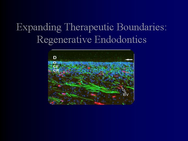 Expanding Therapeutic Boundaries: Regenerative Endodontics 