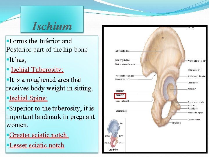Ischium §Forms the Inferior and Posterior part of the hip bone §It has; § Ischium §Forms the Inferior and Posterior part of the hip bone §It has; §