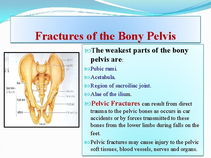 Fractures of the Bony Pelvis The weakest parts of the bony pelvis are: Pubic Fractures of the Bony Pelvis The weakest parts of the bony pelvis are: Pubic