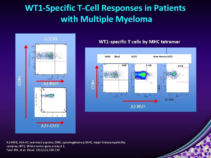 WT 1 -Specific T-Cell Responses in Patients with Multiple Myeloma 4/2/09 WT 1 -specific