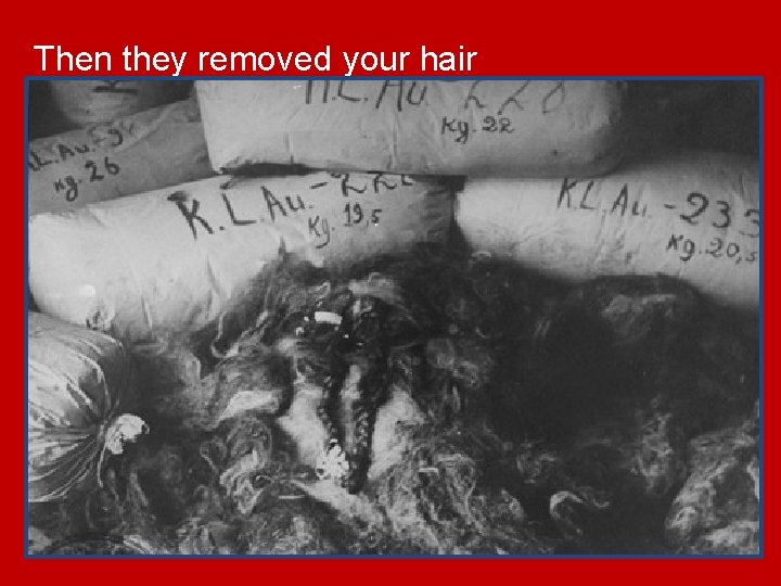 Then they removed your hair 