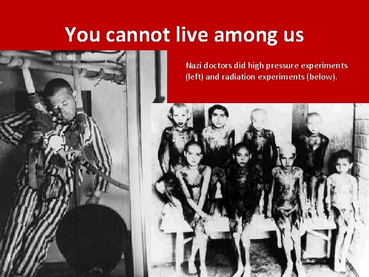 You cannot live among us Nazi doctors did high pressure experiments (left) and radiation