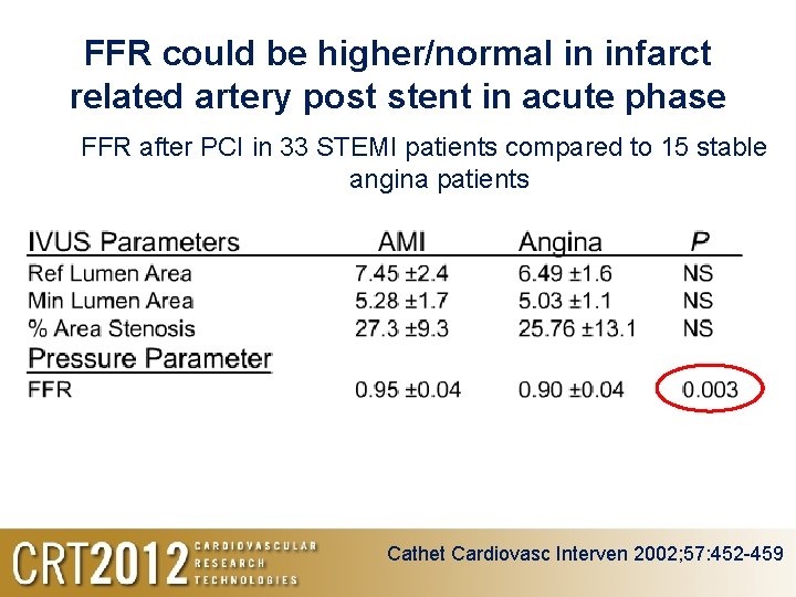 FFR could be higher/normal in infarct related artery post stent in acute phase FFR