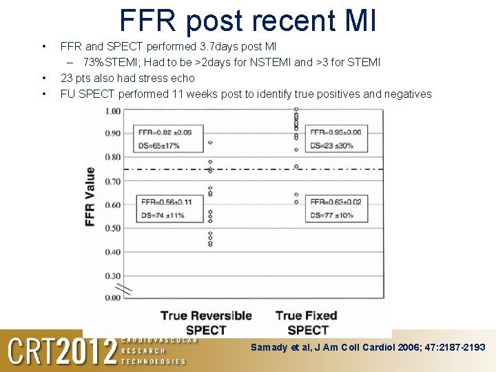 FFR post recent MI • • • FFR and SPECT performed 3. 7 days