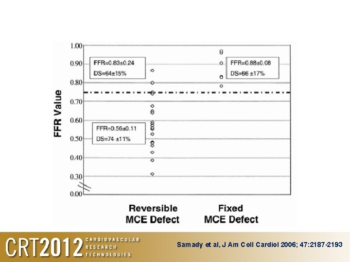 Samady et al, J Am Coll Cardiol 2006; 47: 2187 -2193 