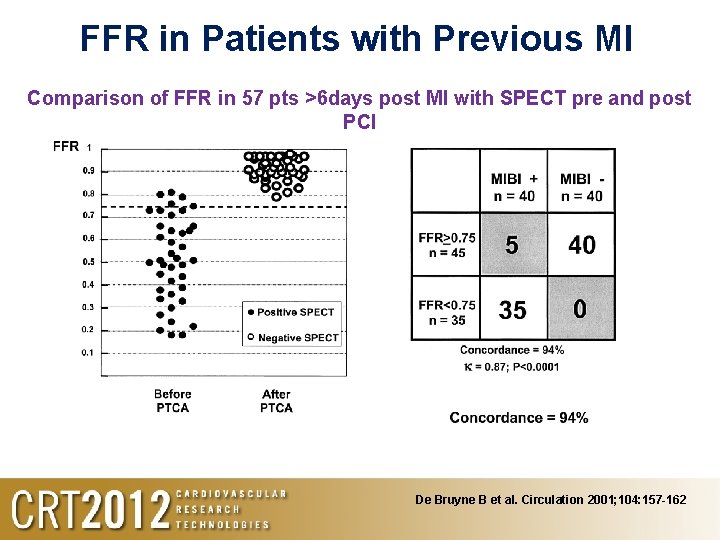 FFR in Patients with Previous MI Comparison of FFR in 57 pts >6 days