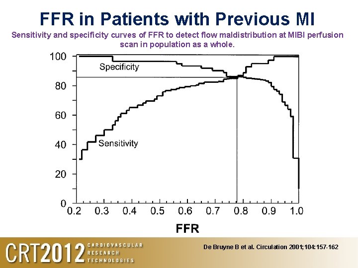 FFR in Patients with Previous MI Sensitivity and specificity curves of FFR to detect