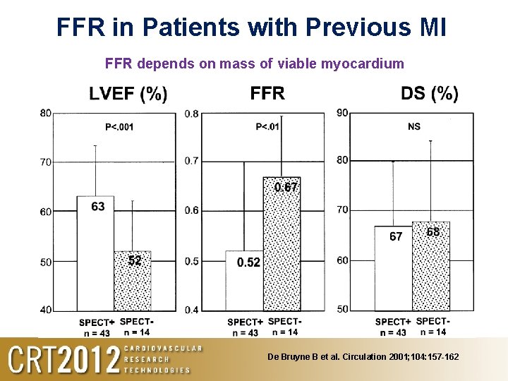 FFR in Patients with Previous MI FFR depends on mass of viable myocardium De