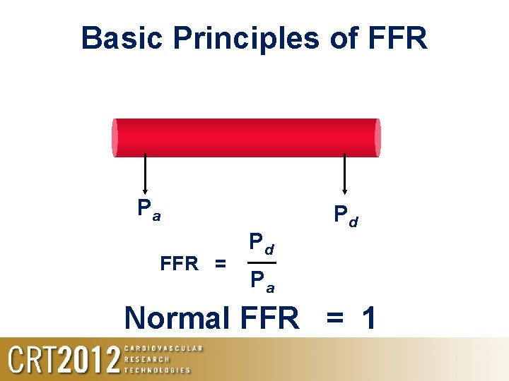 Basic Principles of FFR Pa FFR = Pd Pd Pa Normal FFR = 1