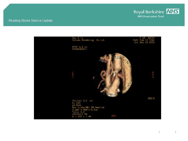 Reading Stroke Service Update 