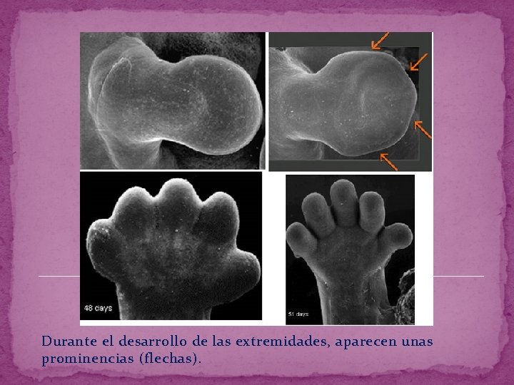 Durante el desarrollo de las extremidades, aparecen unas prominencias (flechas). 