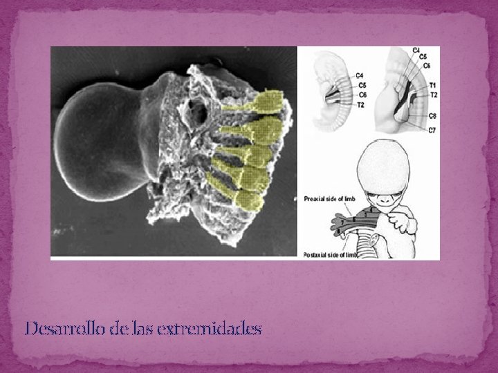 Desarrollo de las extremidades 