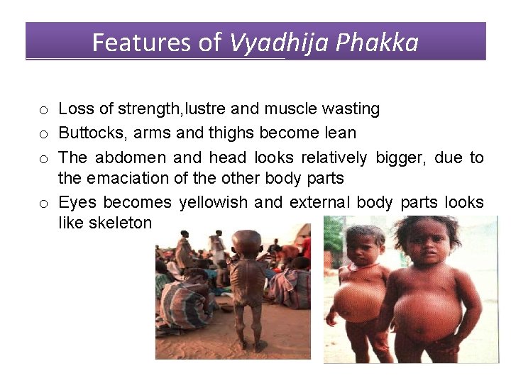 Features of Vyadhija Phakka o Loss of strength, lustre and muscle wasting o Buttocks,