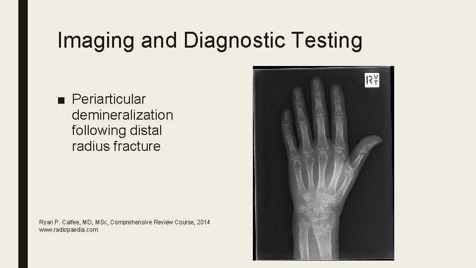 Imaging and Diagnostic Testing ■ Periarticular demineralization following distal radius fracture Ryan P. Calfee,