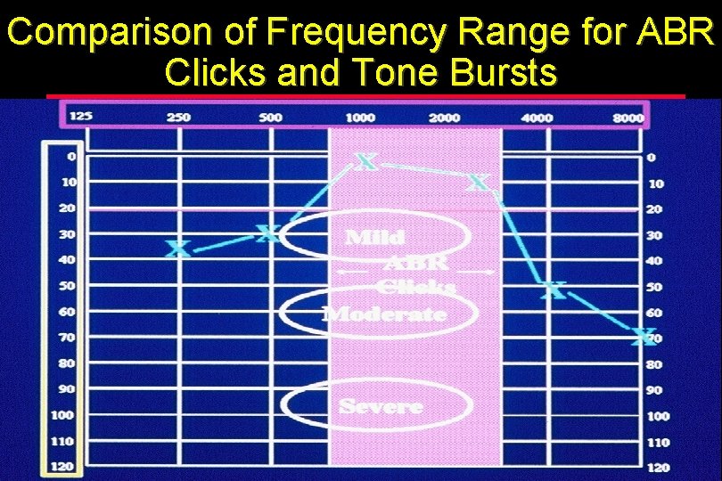 Comparison of Frequency Range for ABR Clicks and Tone Bursts 