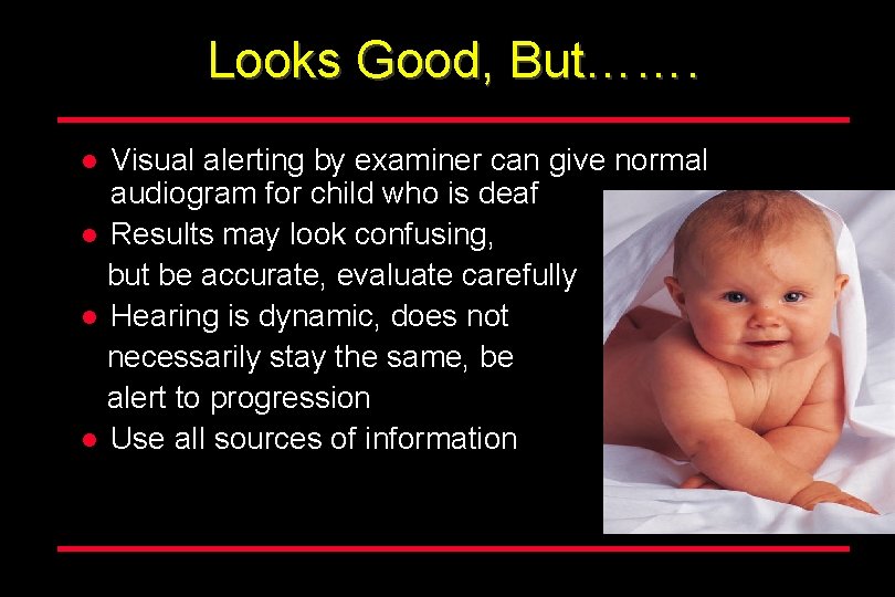 Looks Good, But……. Visual alerting by examiner can give normal audiogram for child who