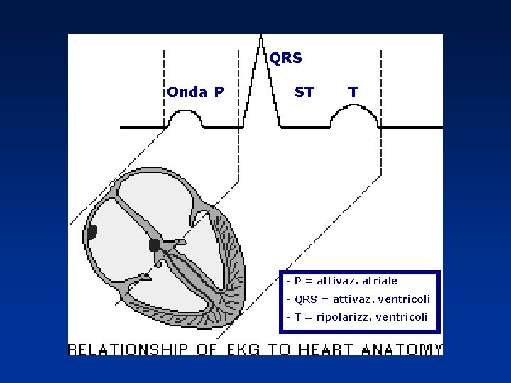 QRS Onda P ST T - P = attivaz. atriale - QRS = attivaz. QRS Onda P ST T - P = attivaz. atriale - QRS = attivaz.